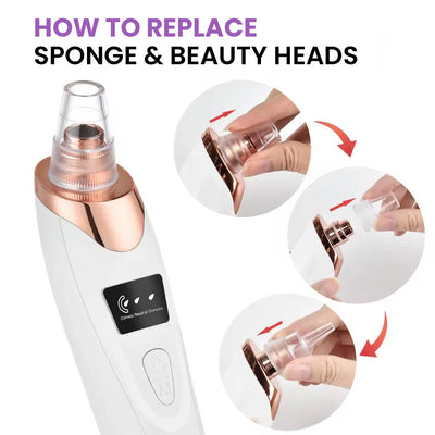 Vacuum Pore Cleaner - Remove Blackheads Without Irritation or Redness